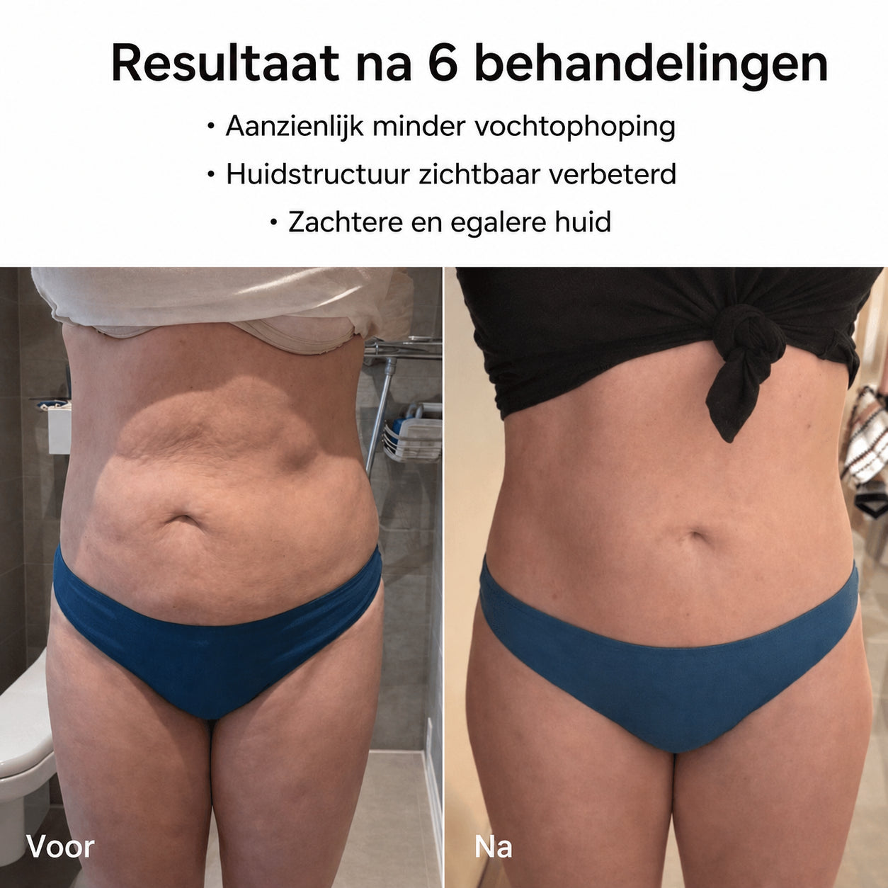 Celluviaa – een gladde huid in 14 dagen