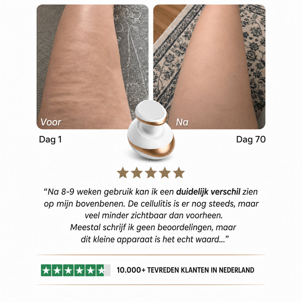 Celluviaa – een gladde huid in 14 dagen