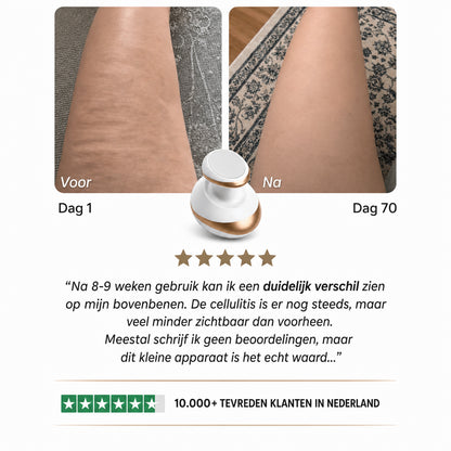 Celluviaa – een gladde huid in 14 dagen