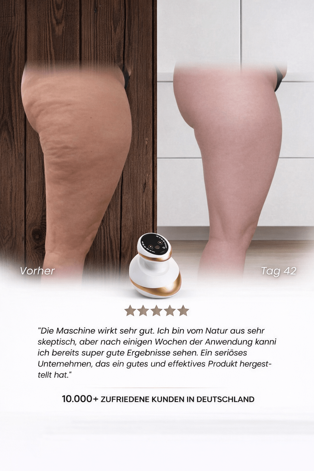 Celluviaa – Cellulite - Behandlung - Celluviaa.com