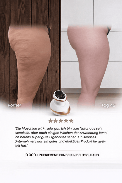 Celluviaa – Cellulite - Behandlung - Celluviaa.com