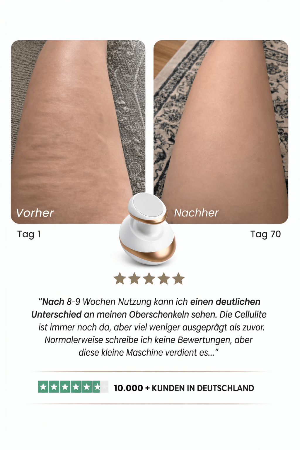 Celluviaa – Cellulite - Behandlung - Celluviaa.com