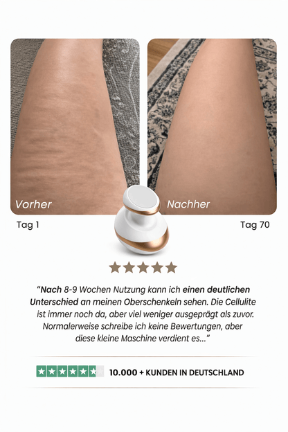 Celluviaa – Cellulite - Behandlung - Celluviaa.com