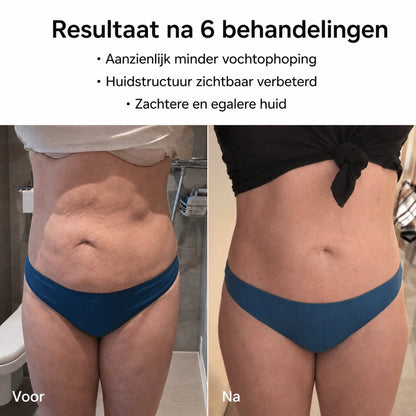 Celluviaa – een gladde huid in 14 dagen - Celluviaa.com