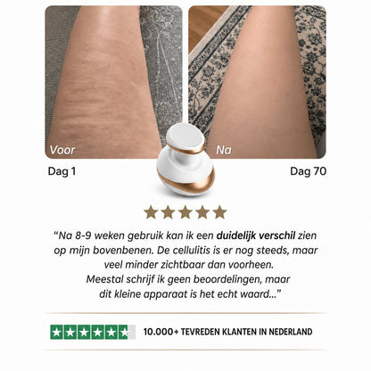 Celluviaa – een gladde huid in 14 dagen - Celluviaa.com