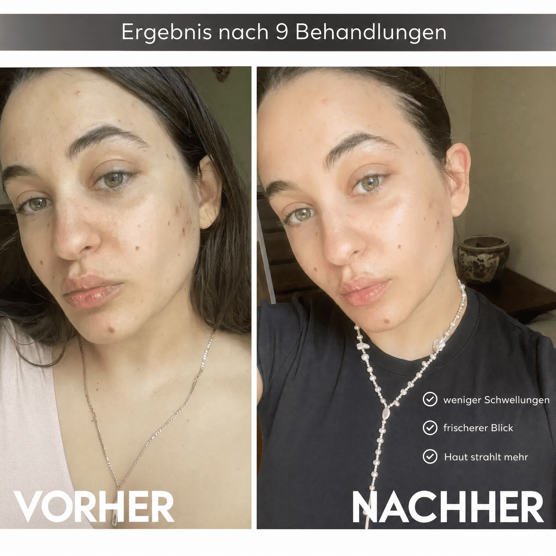 Celluviaa FaceLift Pro 6 in 1 - Skincare für Zuhause - Celluviaa.com