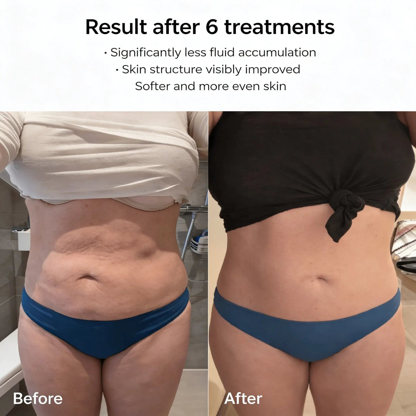 Celluviaa – Smooth Skin in 14 Days - Celluviaa.com