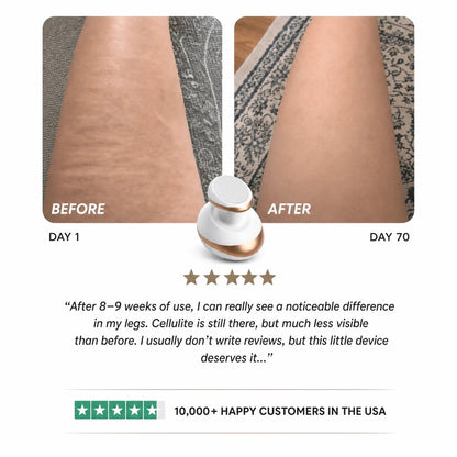 Celluviaa – Smooth Skin in 14 Days - Celluviaa.com